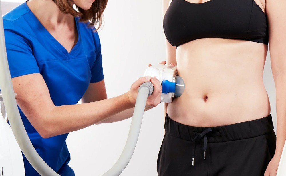 CoolSculpting